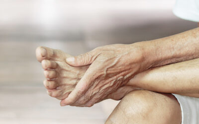Fysiotherapie bij artrose van de botjes in de voet